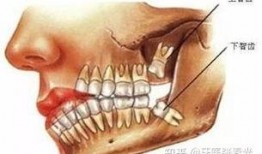 智齿完整版在线观看,揭秘青春成长的秘密与挑战